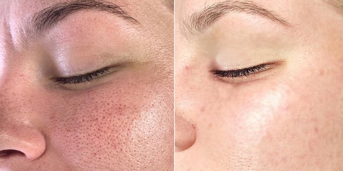 Hidratação Adequada: Equilíbrio Para Evitar Compensação - inspiração 2