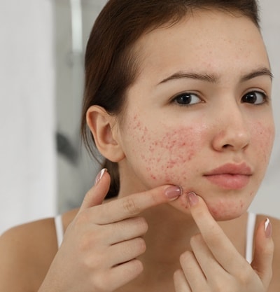 O Poder da Microbiota da Pele: Um Exército Invisível Que Luta Contra Bactérias - inspiração 2