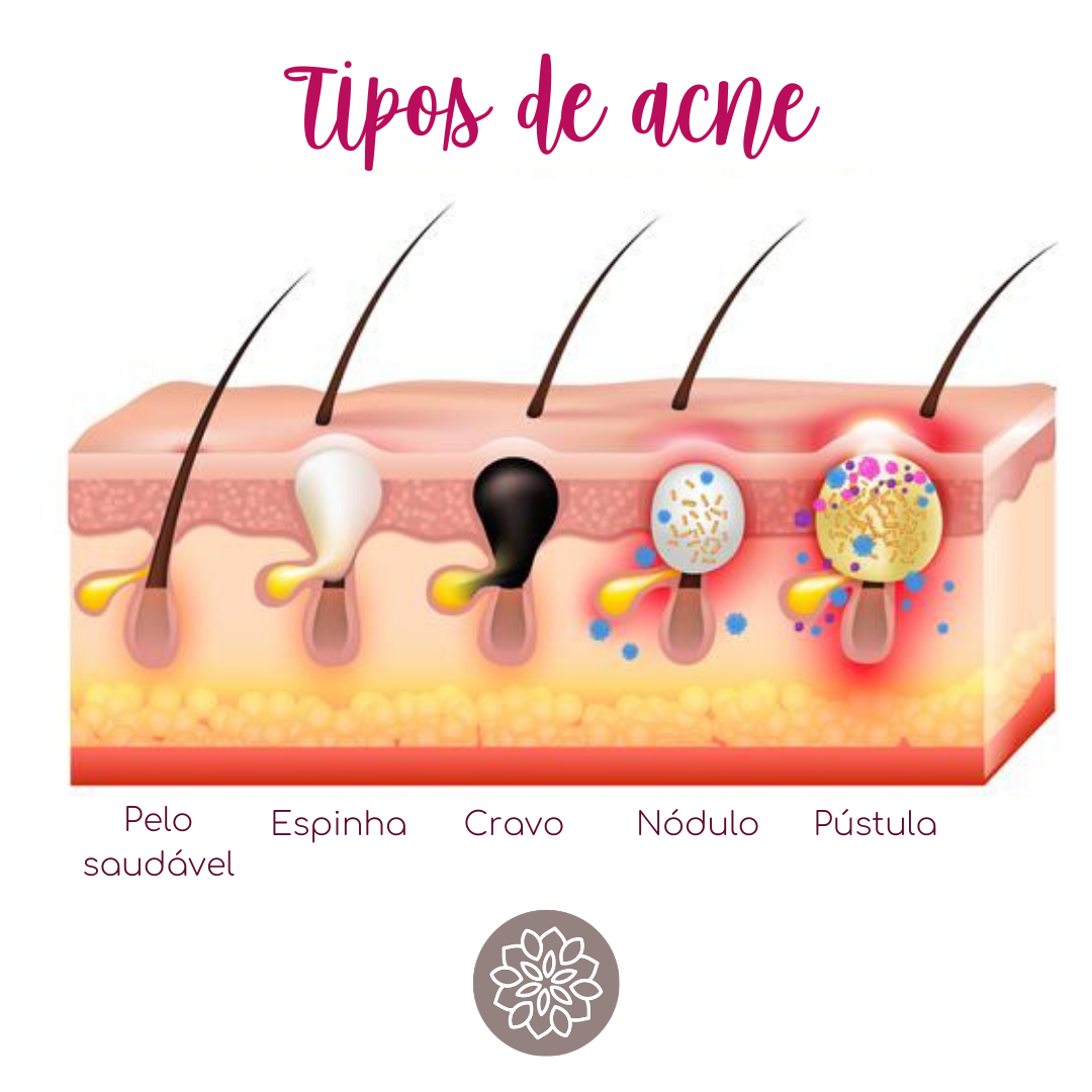 Estresse e o Impacto na Sua Pele: Uma Ligação Mais Forte do Que Você Imagina - inspiração 1