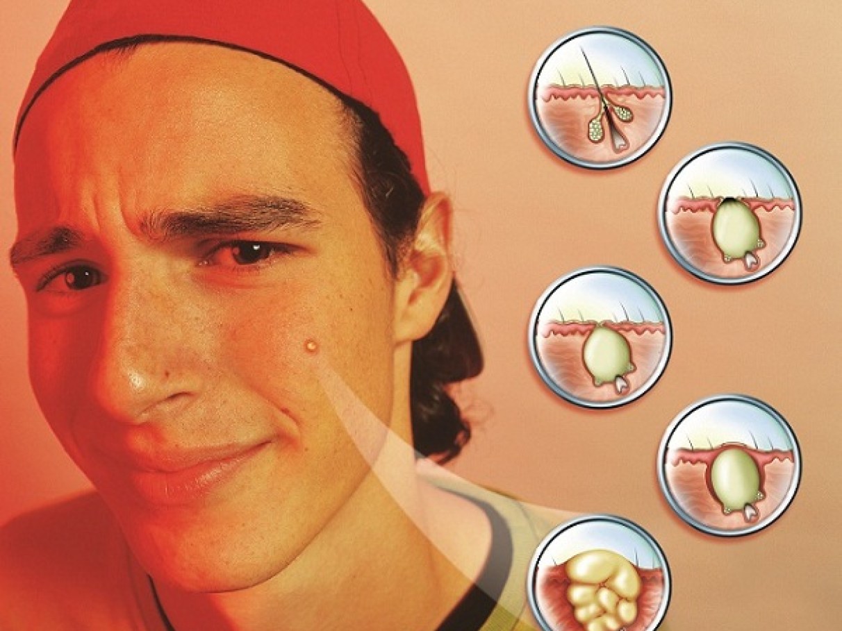 Produtos Inadequados: O Perigo de Usar Cosméticos Que Não Combinam Com Seu Tipo de Pele - inspiração 1