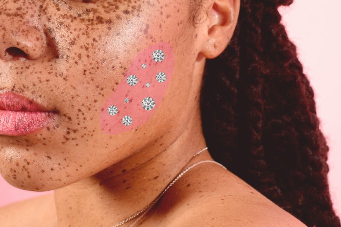 Má Higiene e Rotina de Cuidados: Os Erros Mais Comuns Que Levam a Cravos e Espinhas - inspiração 2