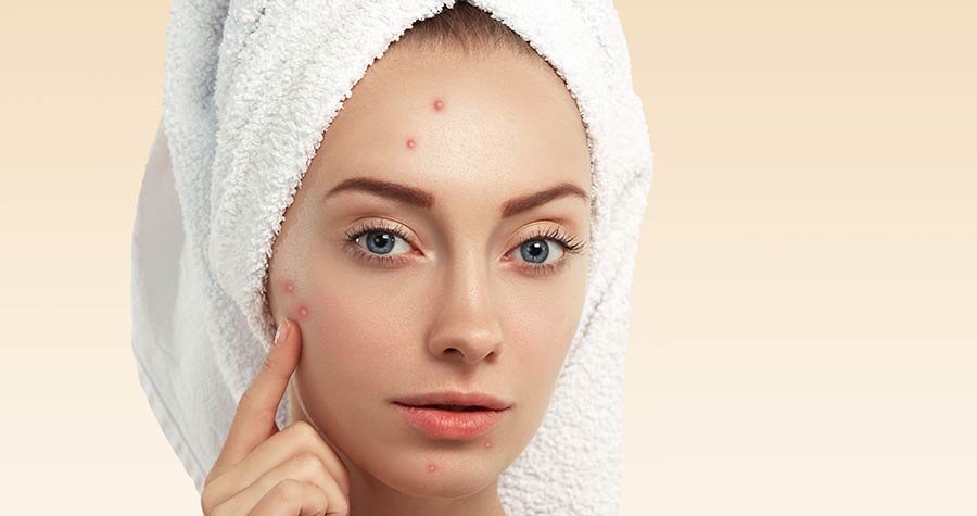 Influência do Clima e Poluição: Agressores Externos Que Pioram a Situação - inspiração 1