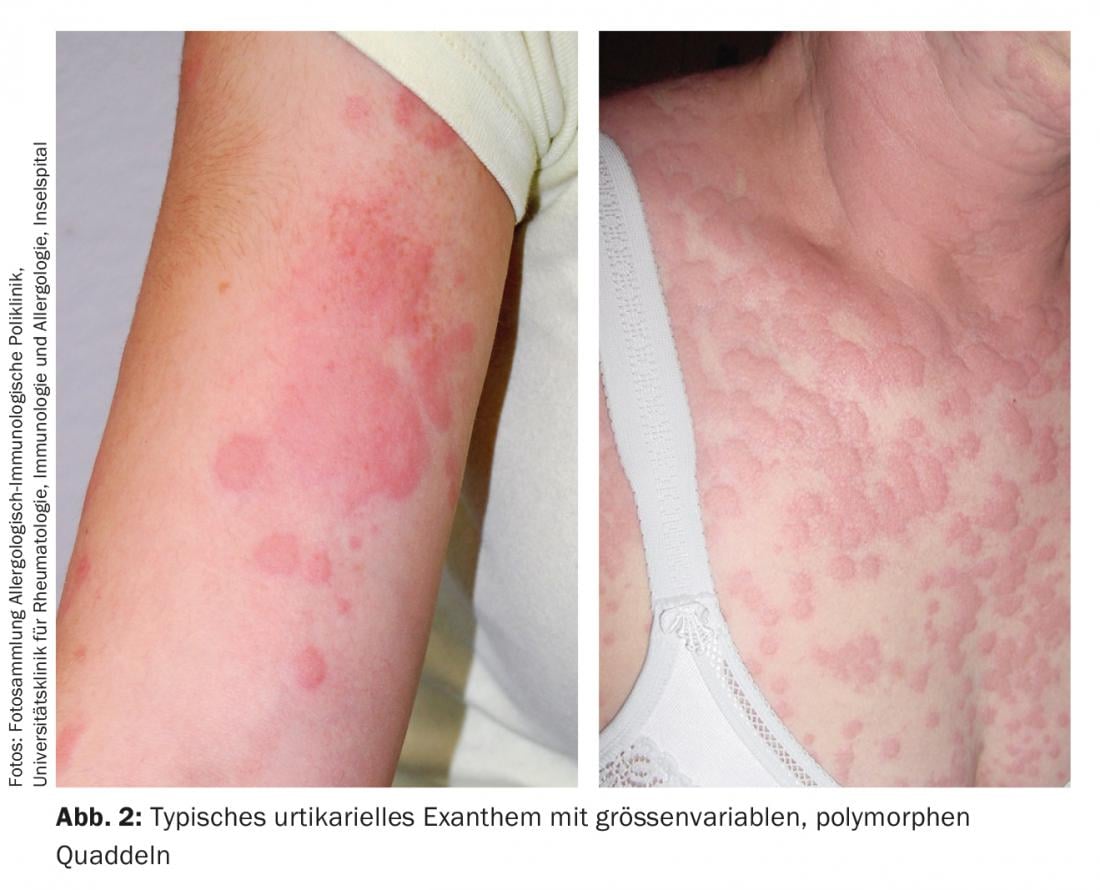 A Arte de Ler Rótulos: Desvendando Ingredientes Ocultos - inspiração 2