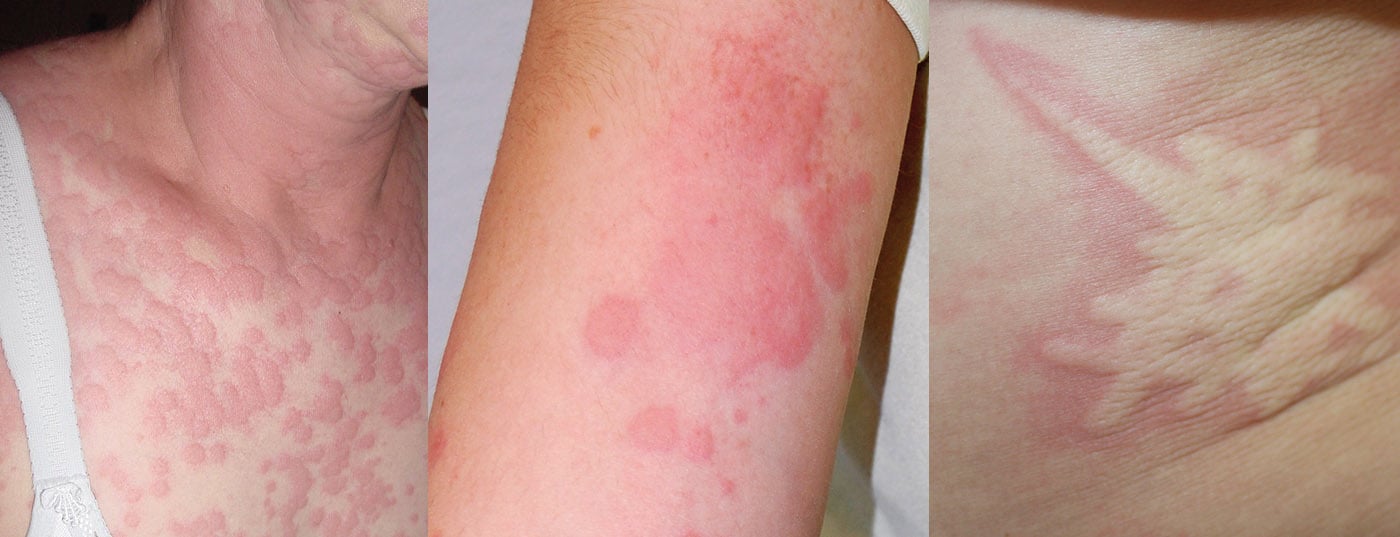 O Impacto das Proteínas: Carnes e Ovos em Detalhe - inspiração 1