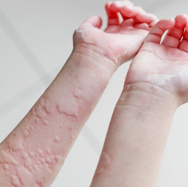 Bebidas e Açúcares: Espumantes e Doces que Podem Inflamar - inspiração 1