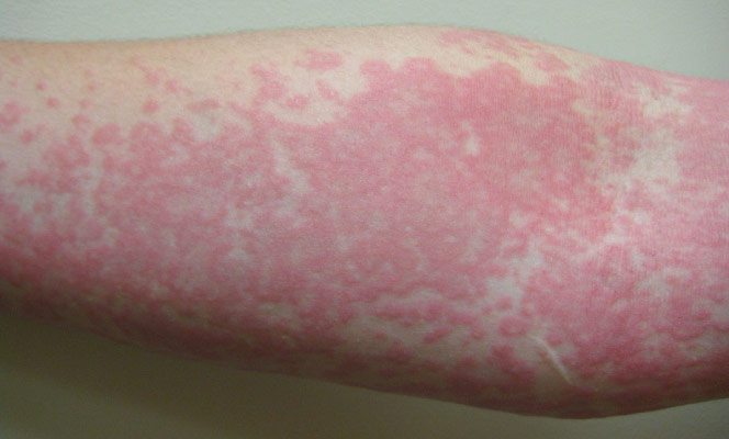 Bebidas e Açúcares: Espumantes e Doces que Podem Inflamar - inspiração 2