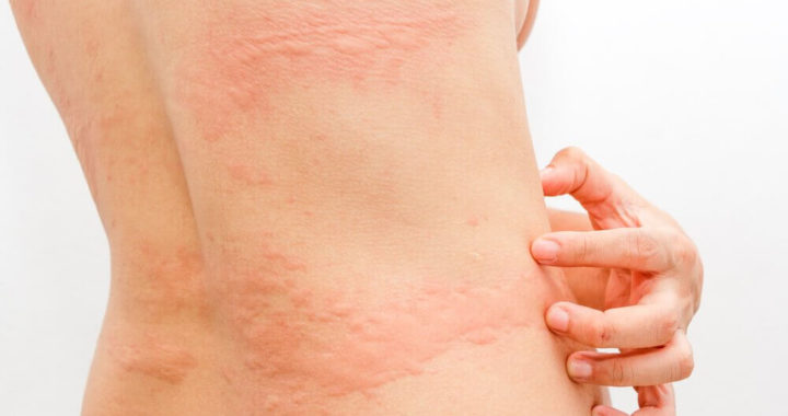 Temperos e Especiarias: Cuidado com os Aromatizantes Fortes - inspiração 1