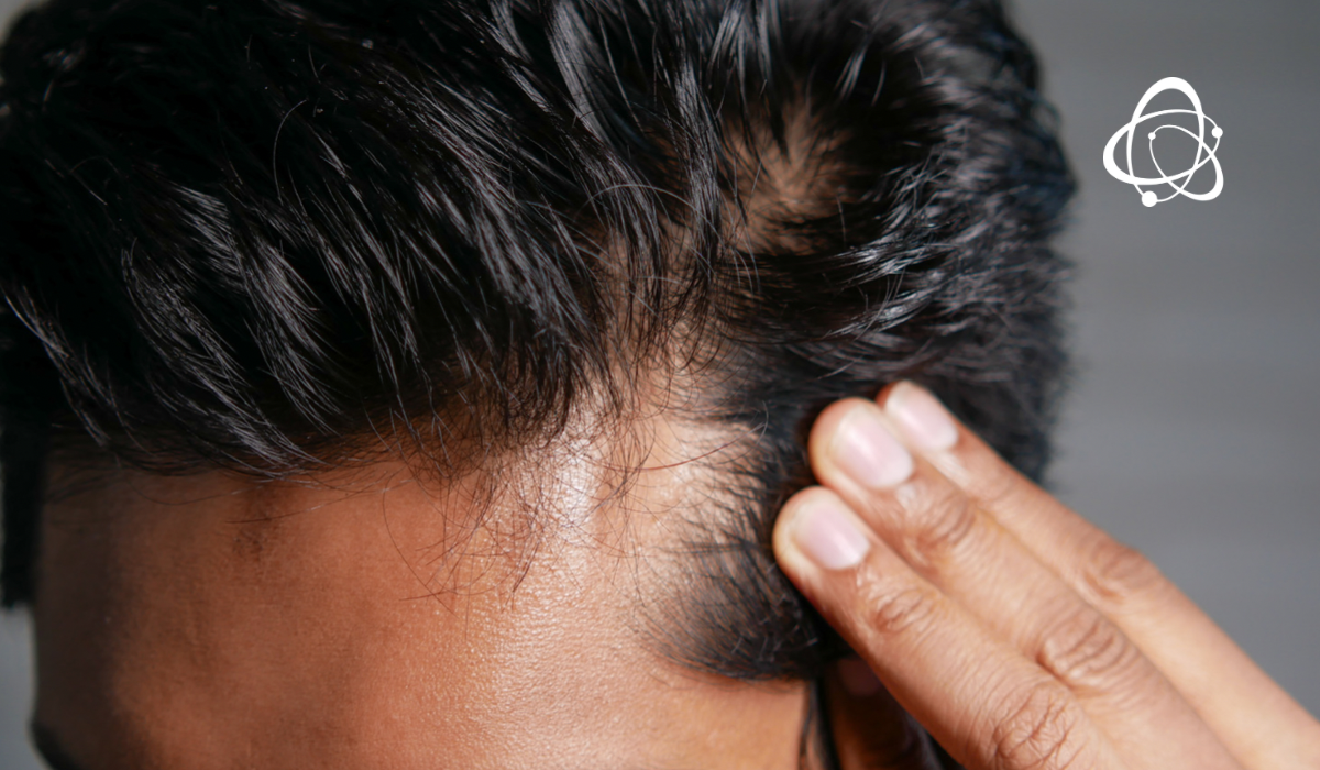 Ingredientes a Evitar: Conheça Vilões Invisíveis Para Cabelos Oleosos - inspiração 1