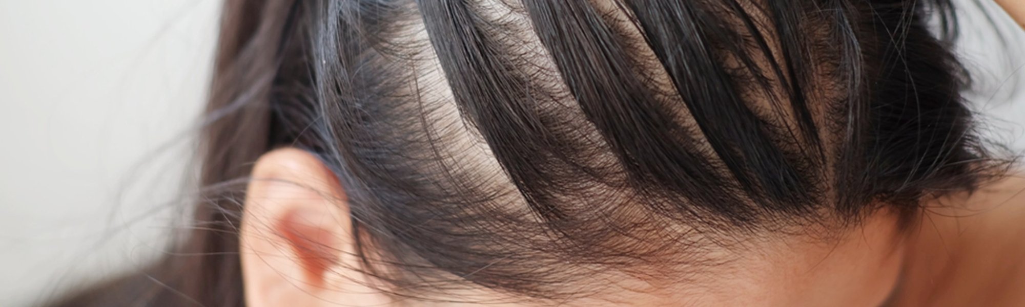 Máscaras Capilares: O Que Funcionam de Verdade Para Controle de Oleosidade - inspiração 1