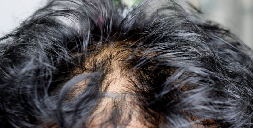 Cuidados Extras no Dia a Dia: Pequenas Mudanças, Grandes Efeitos - inspiração 1