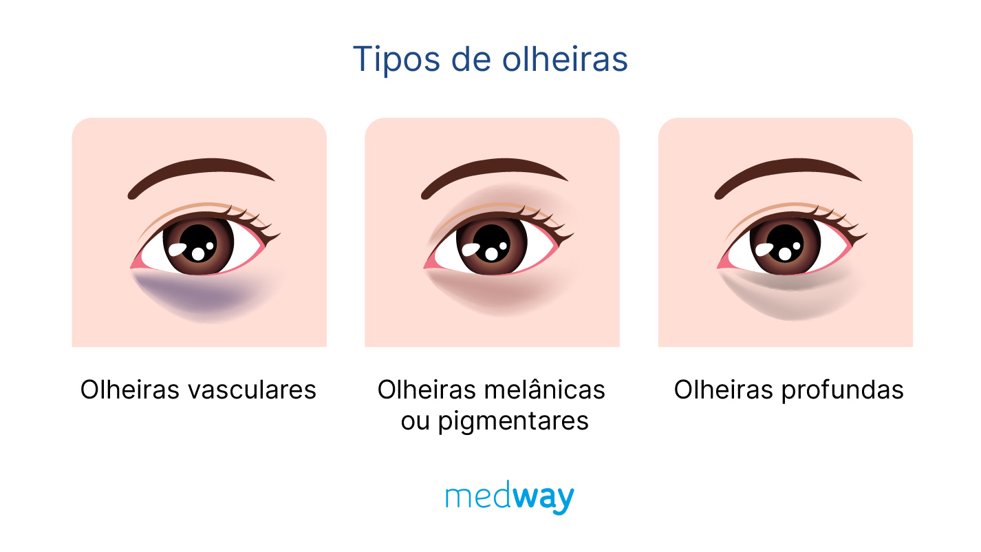 Identificando e Evitando Gatilhos Ambientais e Alergênicos - inspiração 1