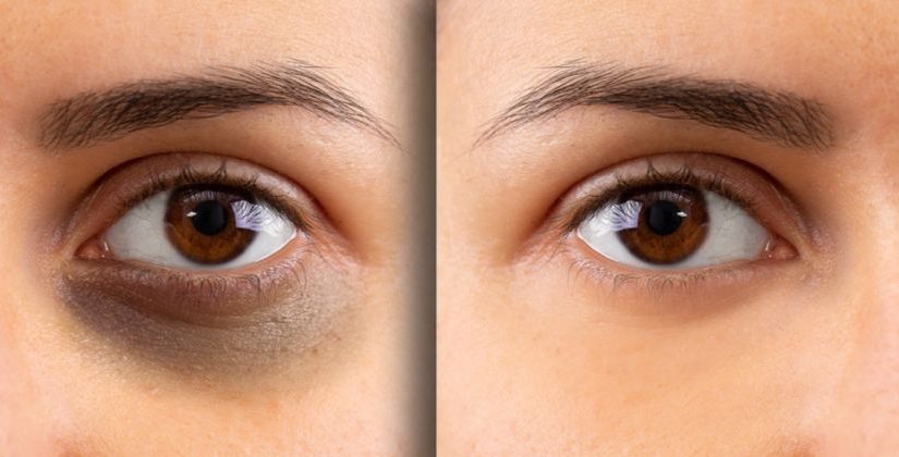 Técnicas de Massagem Suave para Melhorar a Circulação Local - inspiração 1