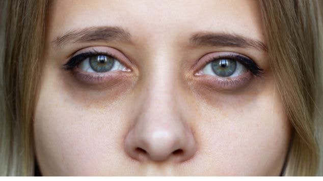 Evite Esfregar os Olhos: Um Hábito Prejudicial à Pele Sensível - inspiração 2