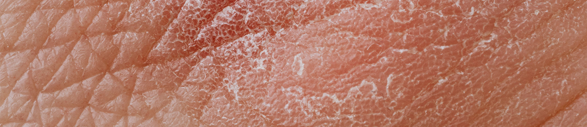 Desidratação e Envelhecimento: Uma Dupla Preocupante - inspiração 2