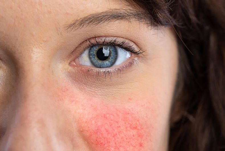 A Importância da Hidratação Interna: Beba Água! - inspiração 2