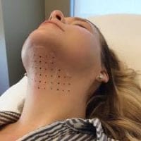 Ácido Deoxicólico Valor