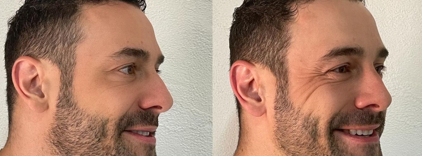 Quem Pode Aplicar Ácido Deoxicólico? Regulamentação e Segurança