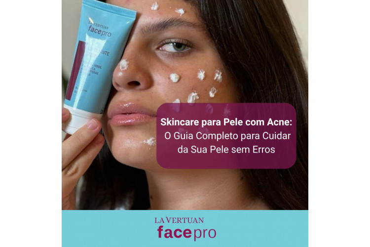 Manchas de Acne: Os Ácidos Mais Eficazes para Clarear e Uniformizar a Pele