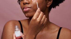 Pele Sensível com Acne: Descubra o Ácido Ideal para Você