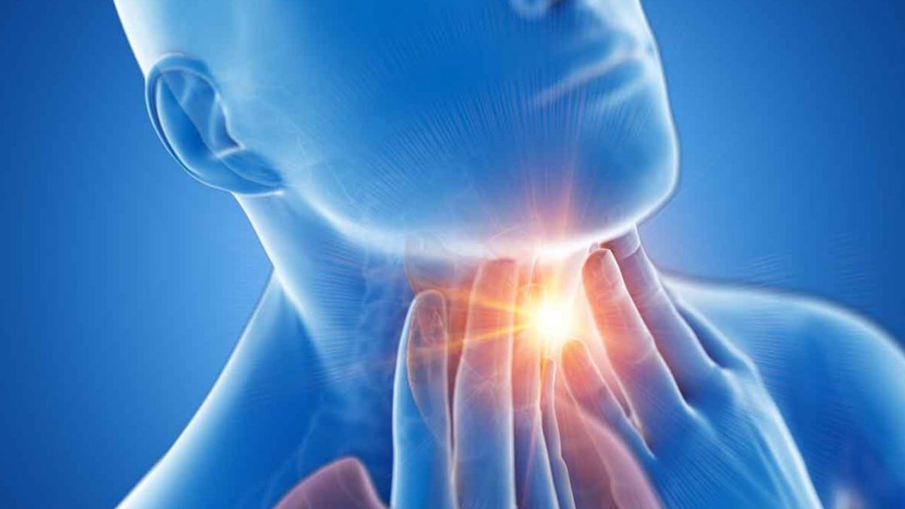 O Impacto do Refluxo na Papilomatose Laríngea: Guia Completo