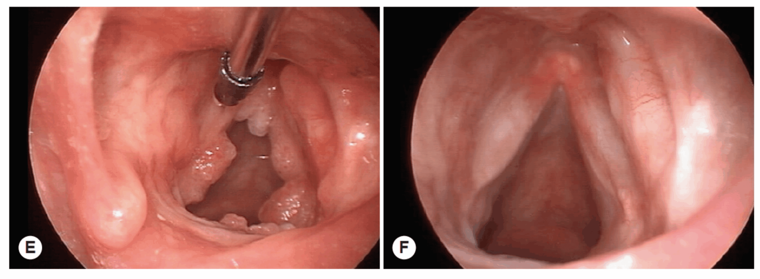 Entenda a Relação entre Tabagismo