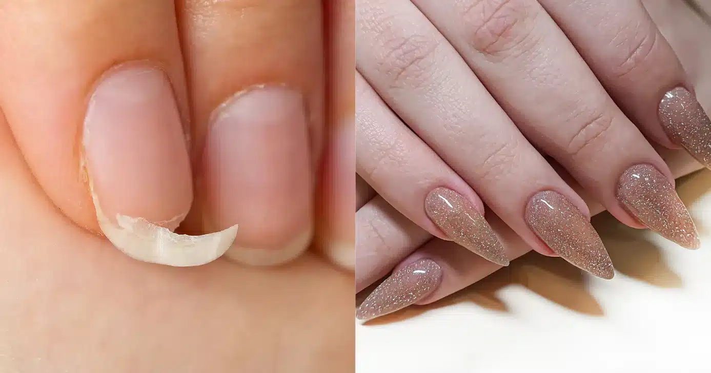 Guia completo: Bases fortalecedoras sem formol