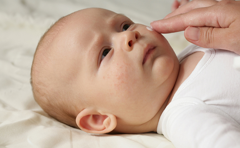 5 ideias de títulos:
1. Brotoeja em Bebês: Guia Completo para Identificação e Cuidados
2. Alívio Rápido: Como Tratar Brotoejas em Recém-Nascidos
3. Prevenindo Brotoejas: Dicas Essenciais para o Verão do seu Bebê
4. Brotoeja ou outra condição? Saiba diferenciar e agir
5. Remédios Caseiros e Médicos para Brotoejas em Bebês: O que Funciona?