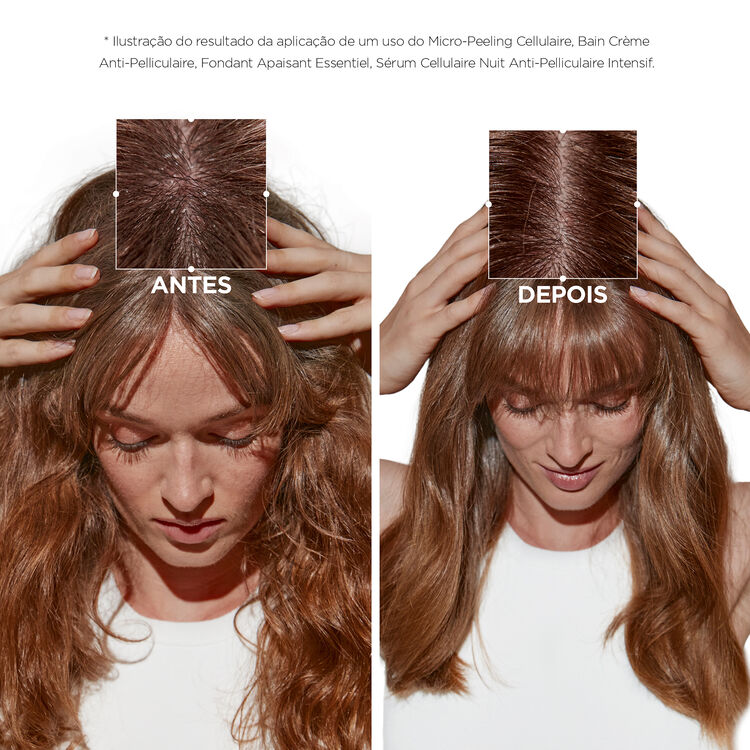 Como a Oleosidade do Couro Cabeludo Afeta o Crescimento do Cabelo