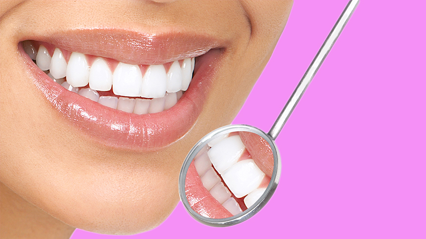 Clareamento a Laser vs. Clareamento Caseiro: Qual o Melhor para Você?