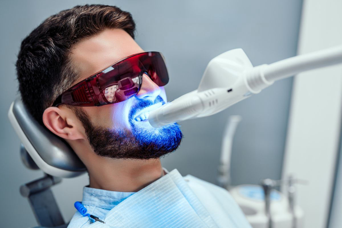 Duração e Manutenção do Clareamento Dental a Laser: Tudo o que Você Precisa Saber
