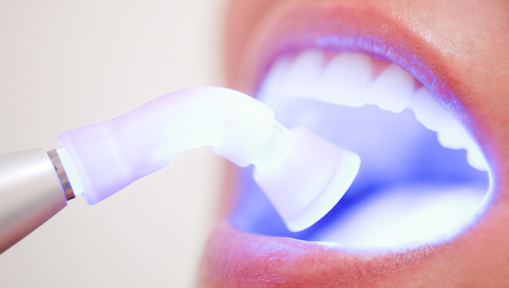 Clareamento Dental a Laser: Mitos, Verdades e Como Funciona