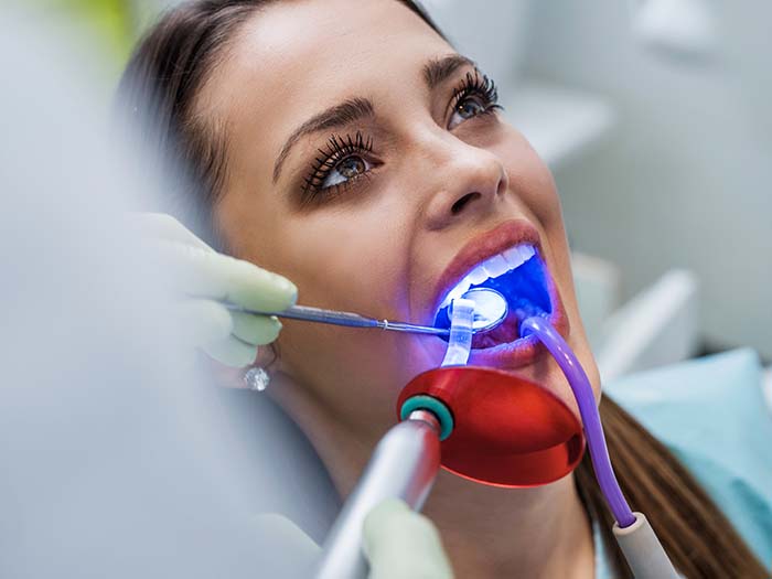 Quanto Custa o Clareamento Dental a Laser? Um Guia Completo
