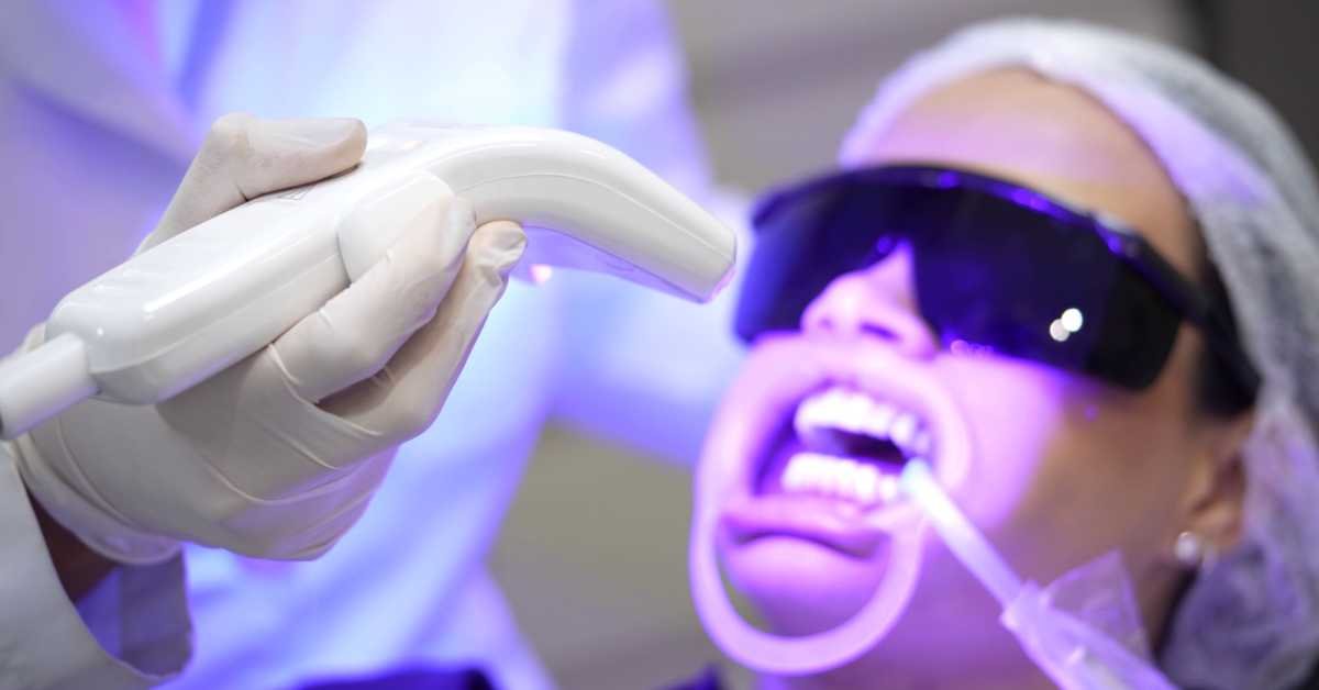 clareamento dental a laser