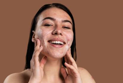 Guia Completo de Ácido Salicílico para Acne