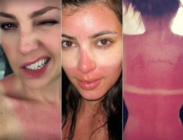 Diferença entre Clareamento e Tratamento de Manchas Solares: O Que Você Precisa Saber