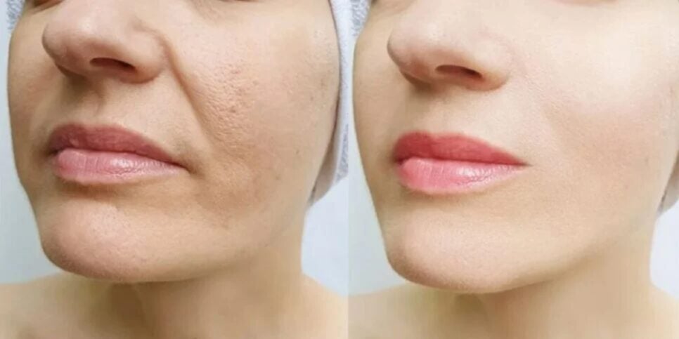 5 Exercícios de Yoga Facial para Iniciantes