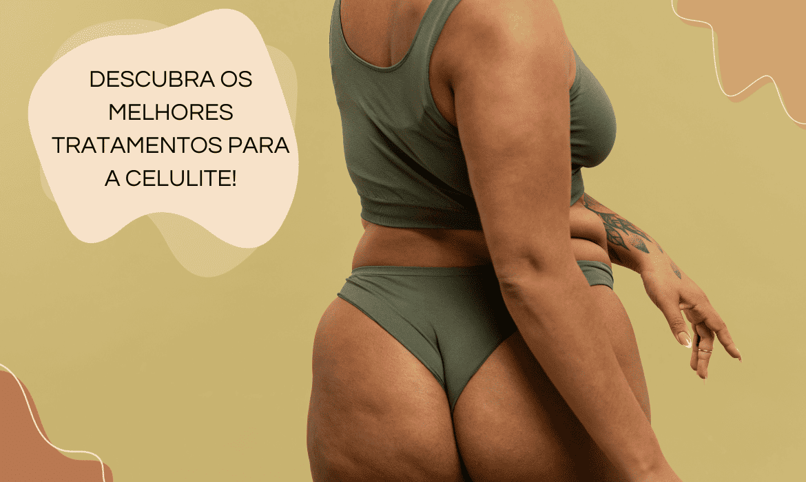 Celulite: Entenda as Causas e Descubra os Tratamentos Mais Eficazes