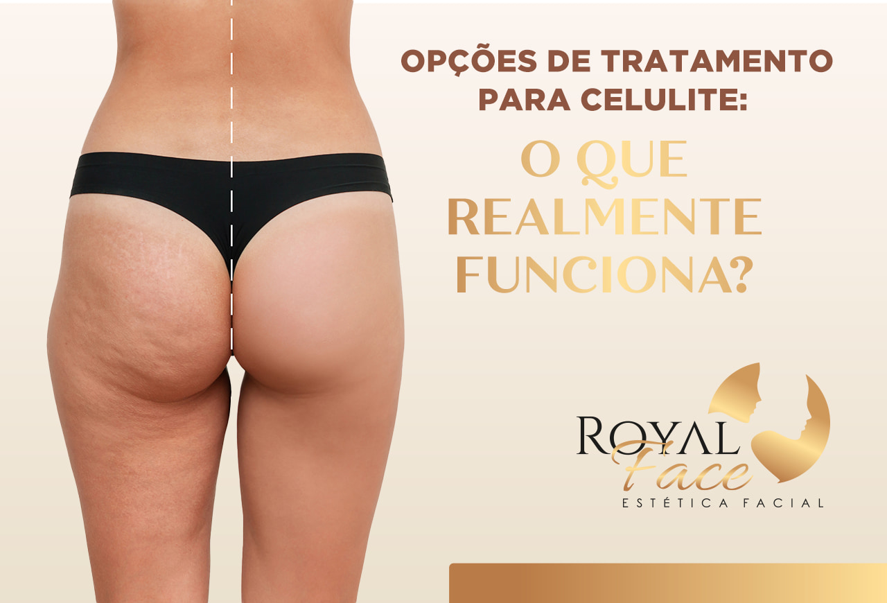 Tratamentos Estéticos Inovadores para Reduzir a Celulite