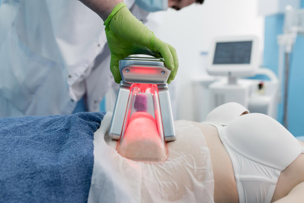 Criomodelagem vs Criolipólise: Qual a Melhor para Você?