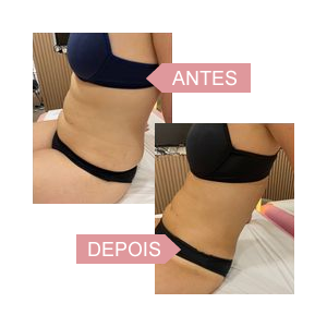 Resultados da Criomodelagem: O que Esperar em 30