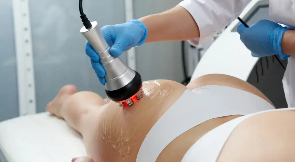 Criomodelagem Facial: Reduza a Papada e Defina o Contorno do Rosto