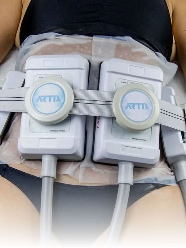 Contraindicações da Criomodelagem: Quem Pode e Quem Não Pode Fazer