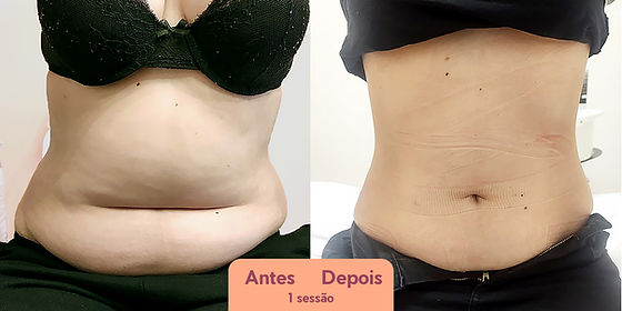 Resultados da Criomodelagem: O que Esperar em 30