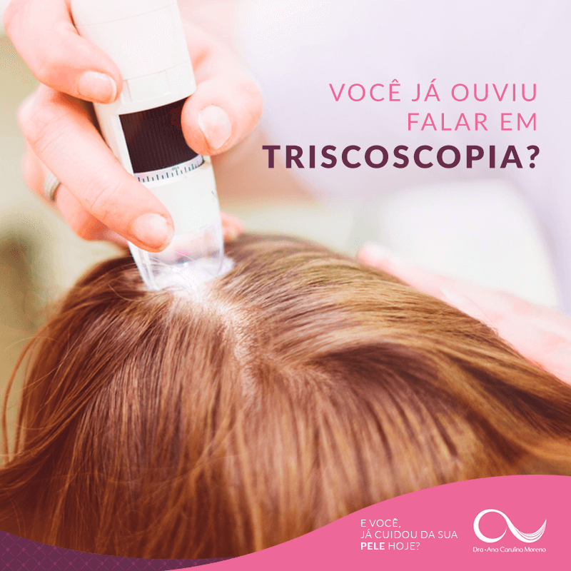 custo total tratamento queda de cabelo