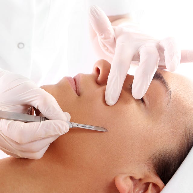Dermaplaning: O Guia Completo para uma Pele Renovada