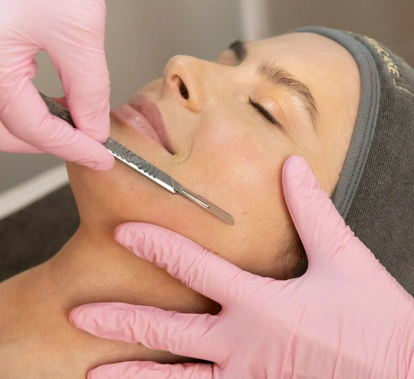 Mitos e Verdades do Dermaplaning: O Que Você Precisa Saber