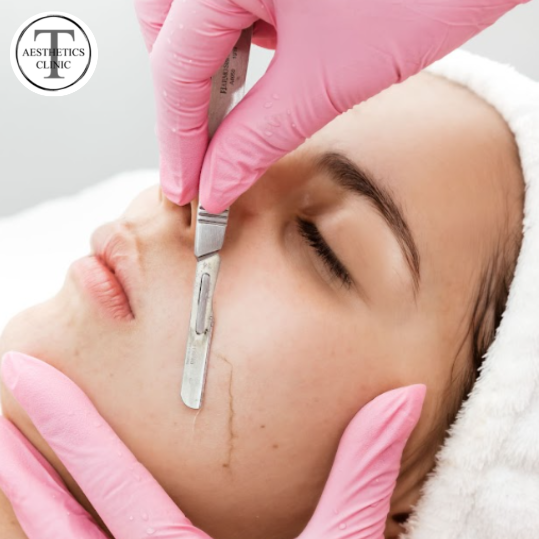 Pós-Dermaplaning: Cuidados Essenciais para Manter sua Pele Impecável