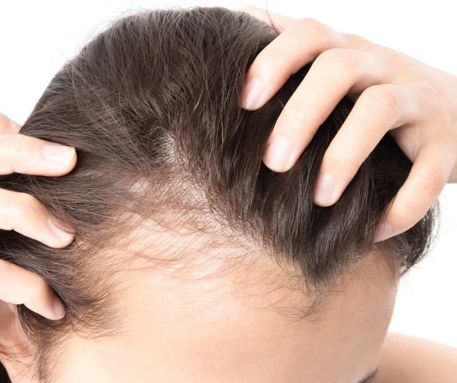 dor no couro cabeludo e queda de cabelo