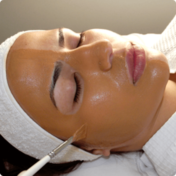 Acne e Melasma: O Peeling Retinóico Pode Ser a Solução?