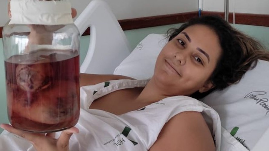 erros que engravidam